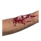 Broken Bone Scar